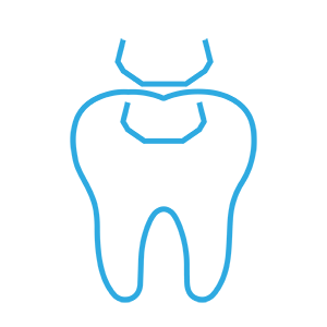 Fillings-01